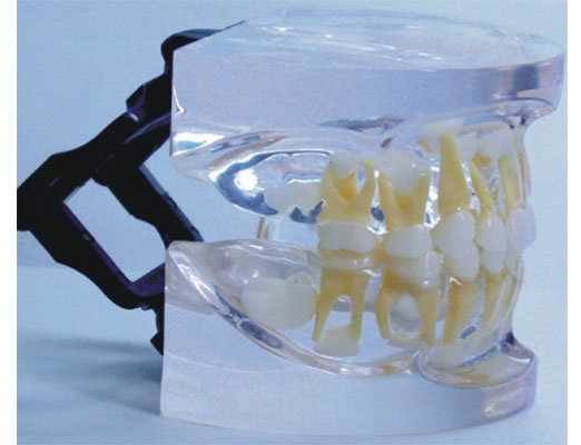 透明乳牙发育模型（5~9岁）